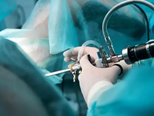 هیسترروسکوپی چیست