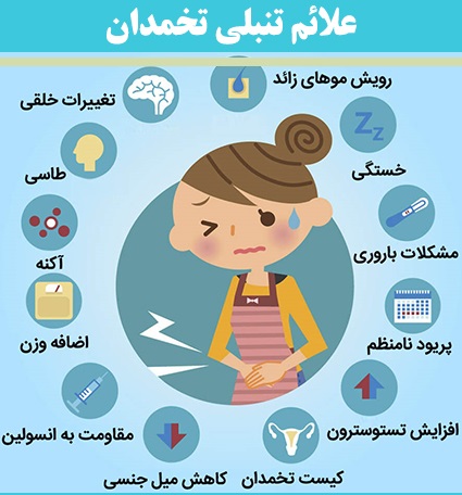 سندرم تخمدان پلی کیستیک یا "PCOS"